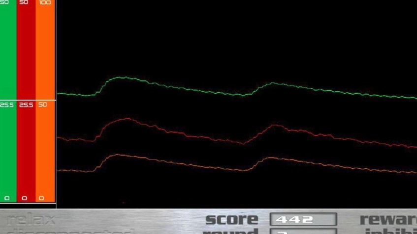 EEG Biofeedback wideogry
